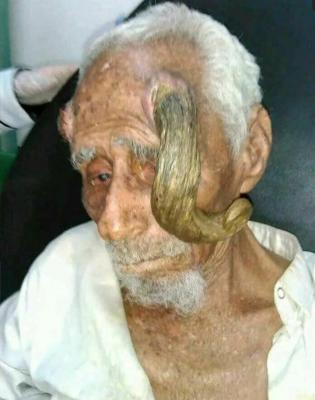 صنعاء نيوز -  

توفي أمس المعمِّر اليمني، علي عنتر، الملقب بـ”ذي القرنين”، المنتمي لمحافظة الجوف (شرق العاصمة صنعاء) عن عمر بلغ 140 عاماً